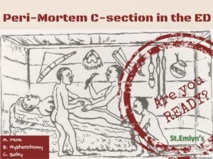 peri mortem section stemlyns