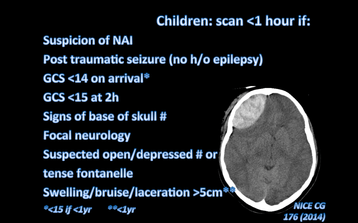 Updated nice head injury guidelines worth a scan 