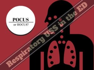 HOCUS