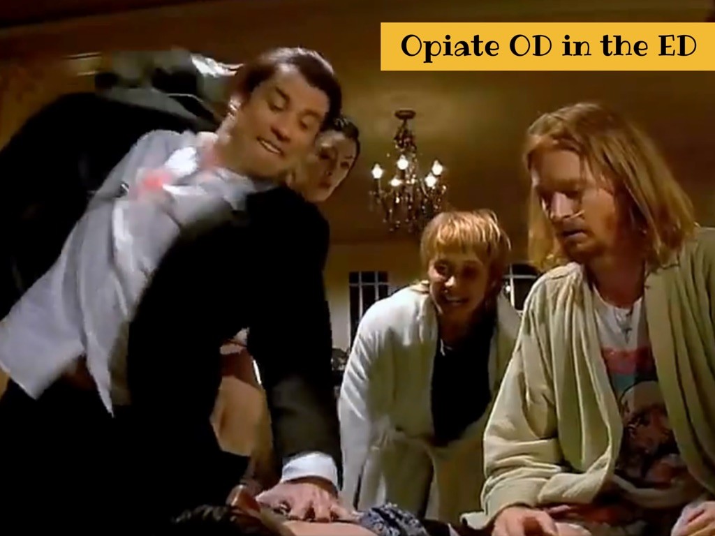 Opiate OD in the ED