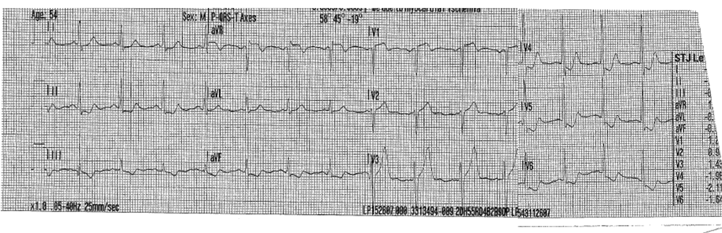 ECG May 2016