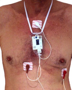 Holter monitor via wikipedia