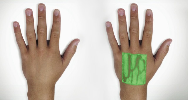 veinviewer