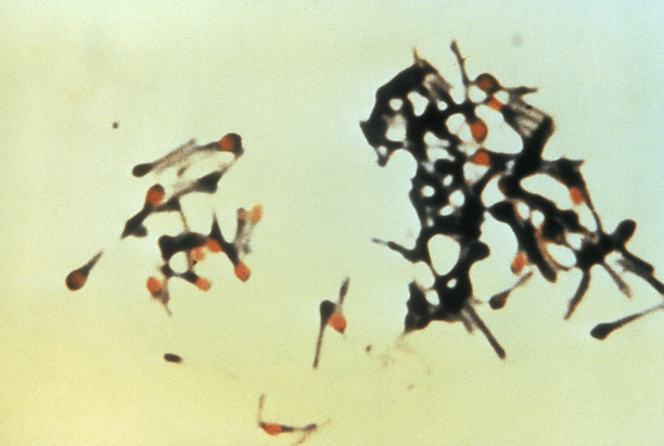 tetanus bacteriae