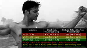 torso trauma chest decompression