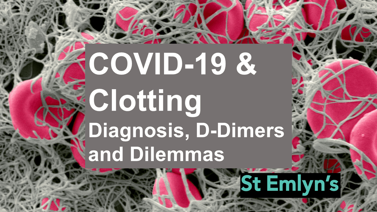 COVID19 and Blood Clots Diagnosis, Ddimers and Dilemmas St Emlyn's