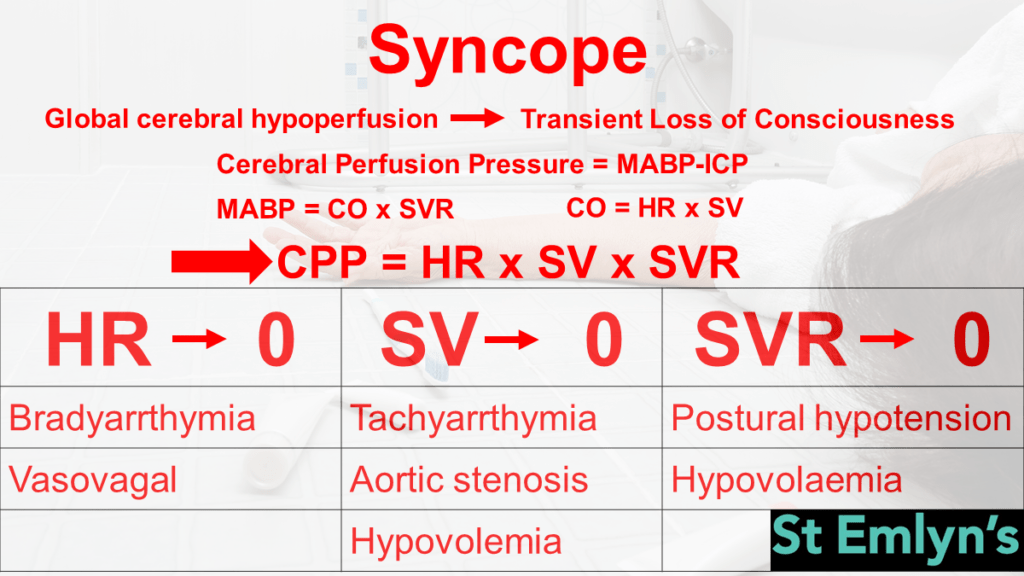 The physiology of syncope
