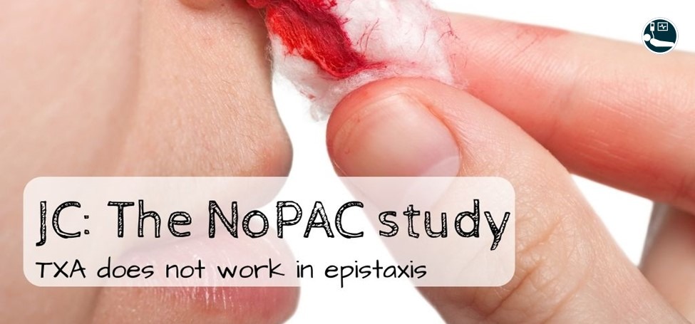 TXA in epistaxis