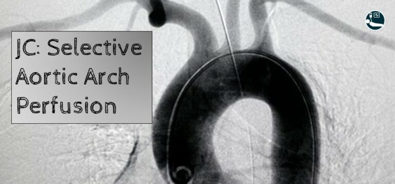Selective Aortic Arch Perfusion
