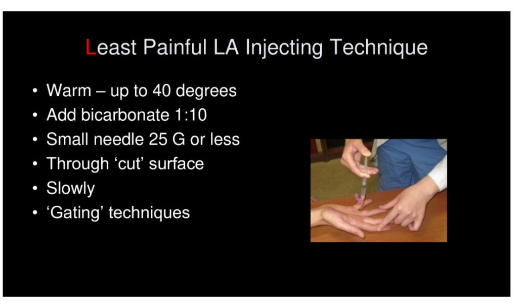 Least Painful LA Injecting Technique
Warm-up to 40 degrees
• Add bicarbonate 1:10
• Small needle 25 G or less
• Through 'cut' surface
• Slowly
• 'Gating' techniques