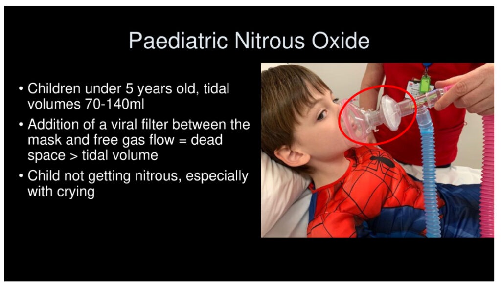 Paediatric Nitrous Oxide
• Children under 5 years old, tidal
·
·
volumes 70-140ml
Addition of a viral filter between the mask and free gas flow = dead space> tidal volume
• Child not getting nitrous, especially with crying