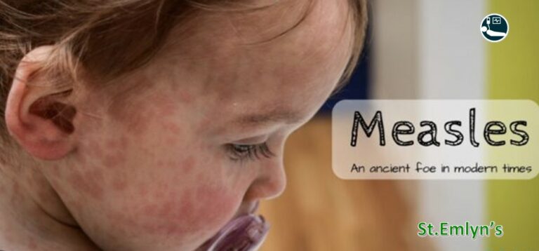 measles