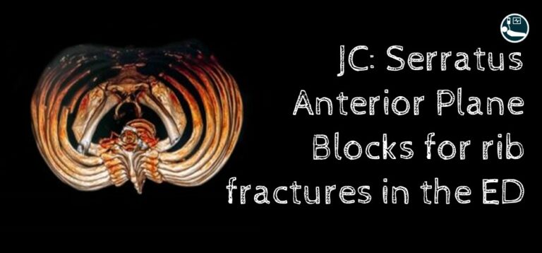 Serratus Anterior Plane Blocks in eth ED Journal Club