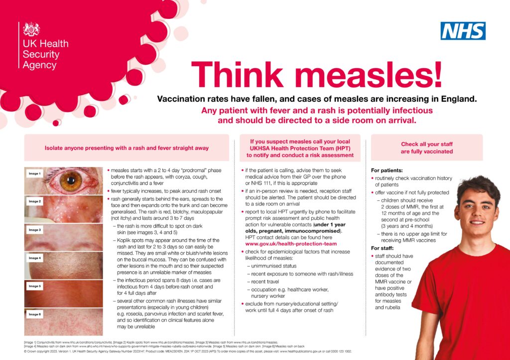UK Health Security Agency
Think measles!
Vaccination rates have fallen, and cases of measles are increasing in England. Any patient with fever and a rash is potentially infectious
Isolate anyone presenting with a rash and fever straight away
and should be directed to a side room on arrival.
• measles starts with a 2 to 4 day "prodromal" phase before the rash appears, with coryza, cough, conjunctivitis and a fever
• fever typically increases, to peak around rash onset
• rash generally starts behind the ears, spreads to the face and then expands onto the trunk and can become generalised. The rash is red, blotchy, maculopapular (not itchy) and lasts around 3 to 7 days
the rash is more difficult to spot on dark skin (see images 3, 4 and 5)
- Koplik spots may appear around the time of the rash and last for 2 to 3 days so can easily be missed. They are small white or bluish/white lesions on the buccal mucosa. They can be confused with other lesions in the mouth and so their suspected presence is an unreliable marker of measles
- the infectious period spans 8 days i.e. cases are infectious from 4 days before rash onset and for 4 full days after
- several other common rash illnesses have similar presentations (especially in young children)
e.g. roseola, parvovirus infection and scarlet fever, and so identification on clinical features alone may be unreliable
If you suspect measles call your local UKHSA Health Protection Team (HPT) to notify and conduct a risk assessment
if the patient is calling, advise them to seek medical advice from their GP over the phone or NHS 111, if this is appropriate
• if an in-person review is needed, reception staff should be alerted. The patient should be directed to a side room on arrival
report to local HPT urgently by phone to facilitate prompt risk assessment and public health action for vulnerable contacts (under 1 year olds, pregnant, immunocompromised). HPT contact details can be found here www.gov.uk/health-protection-team
•check for epidemiological factors that increase likelihood of measles:
- unimmunised status
- recent exposure to someone with rash/illness - recent travel
- occupation e.g. healthcare worker, nursery worker
• exclude from nursery/educational setting/ work until full 4 days after onset of rash
For patients:
Check all your staff
are fully vaccinated
⚫ routinely check vaccination history of patients
• offer vaccine if not fully protected
- children should receive
2 doses of MMR, the first at
12 months of age and the second at pre-school
(3 years and 4 months)
- there is no upper age limit for receiving MMR vaccines For staff:
• staff should have documented
evidence of two doses of the MMR vaccine or have positive antibody tests for measles
and rubella
[Image 1] Conjunctivitis from www.nhs.uk/conditions/conjunctivitis. [Image 2] Koplik spots from www.nhs.uk/conditions/measles. [Image 3] Measles rash from www.nhs.uk/conditions/measles. [Image 4] Measles rash on dark skin from www.afro.who.int/news/who-supports-government-mitigate-measles-rubella-outbreaks-nationwide. [Image 5] Measles rash on dark skin. [Image 6] Measles rash on back
Crown copyright 2023. Version 1. UK Health Security Agency Gateway Number 2023147. Product code: MEA2301EN. 20K 1P OCT 2023 (APS) To order more copies of this asset, please visit: www.health publications.gov.uk or call 0300 123 1002.