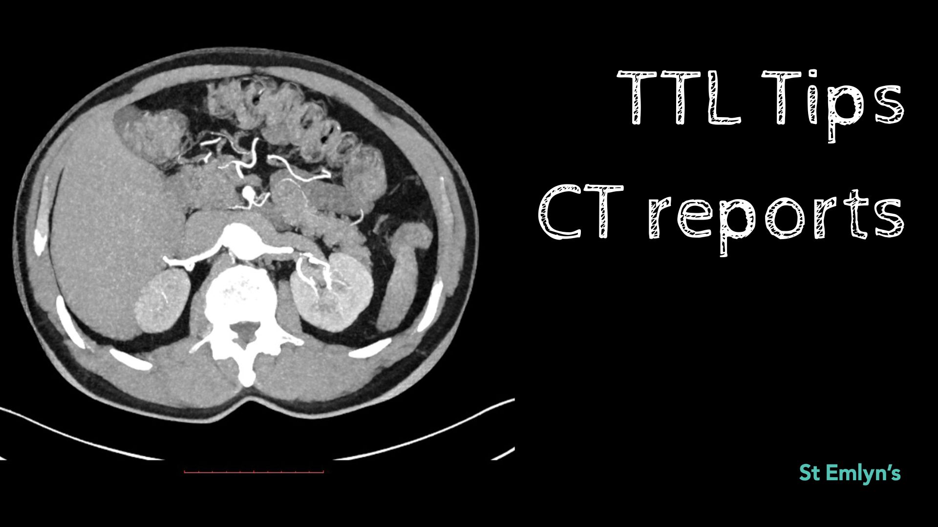 TTL tips 6: CT reports