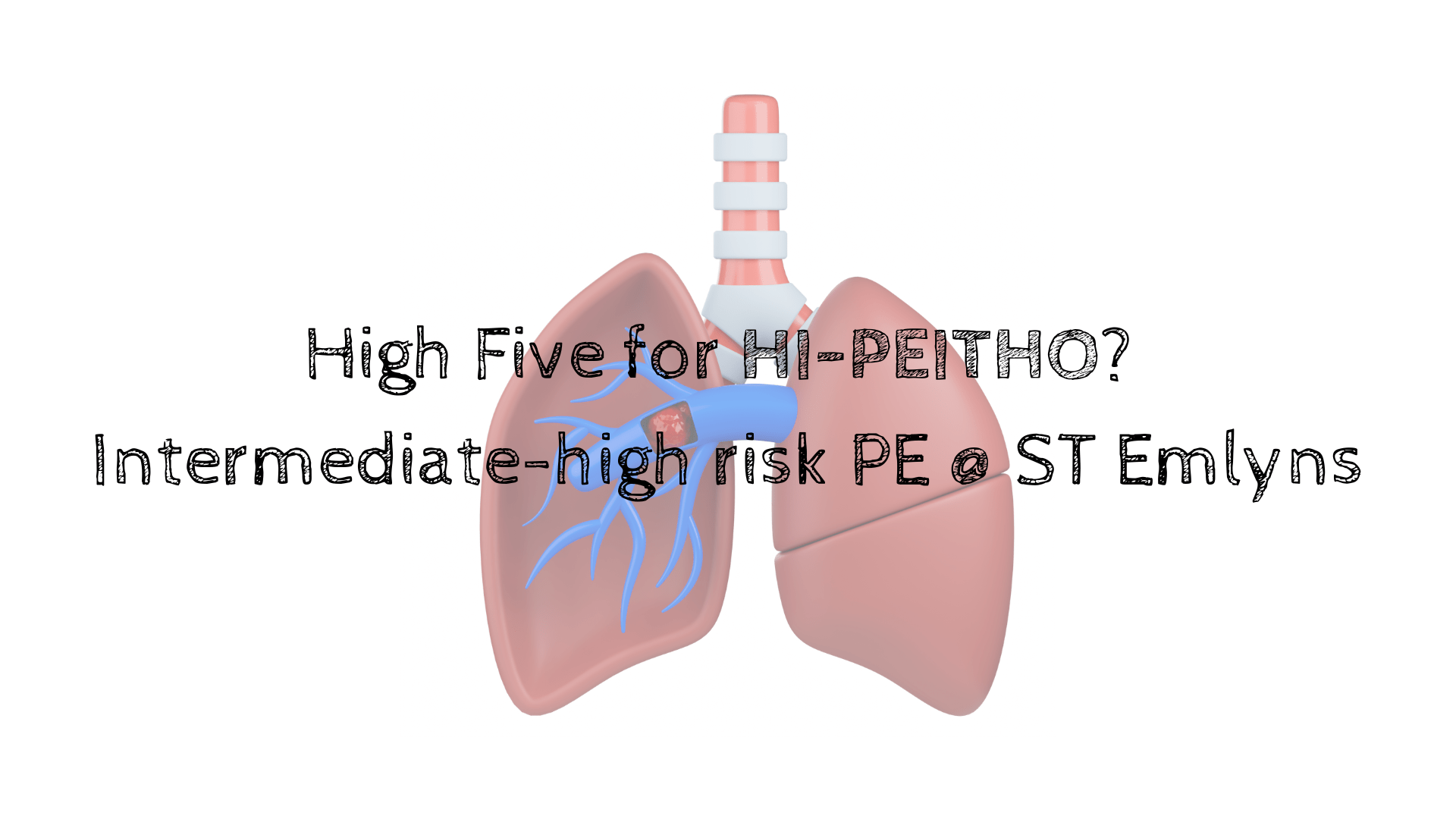 Peitho High Five for High PEITHO? Intermediate-high risk PE @ St Emlyns